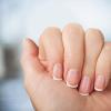 Заусенцы на пальцах, причины появления, удаление, лечение, профилактика